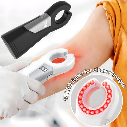 جهاز كاشف الأوردة المحمول.. الحل الذكي لعيادتك. 🏥